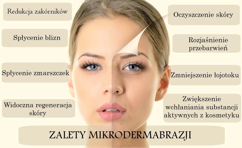 Mikrodermabrazja zalety