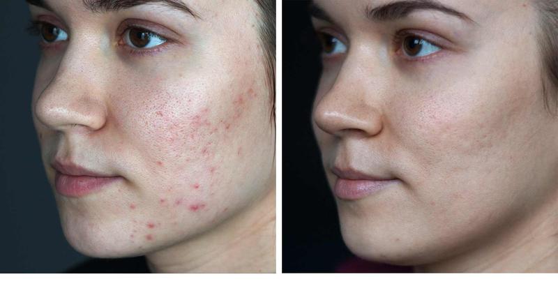 Dieta a regeneracja skóry