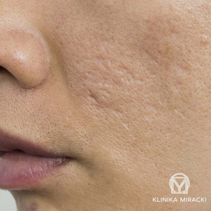 Pielęgnacja skóry twarzy