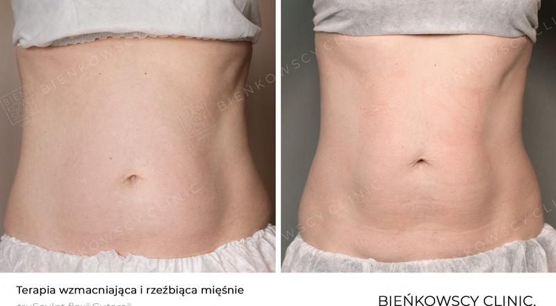 Budowanie mięśni bez siłowni