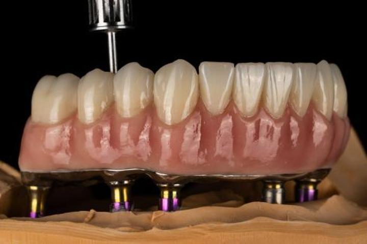 Implantolog zdrowie jamy ustnej