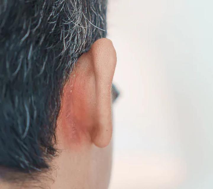 Naturalne sposoby na skórę