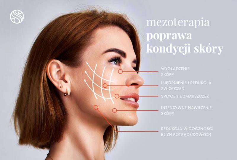 Odkryj tajniki mezoterapii igłowej i odzyskaj promienną skórę
