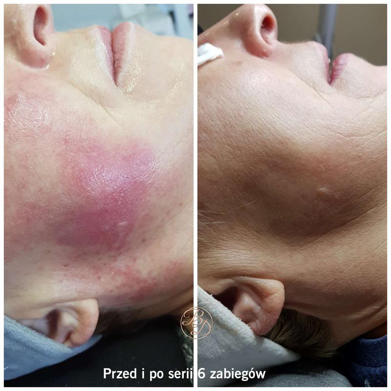 Dieta a zdrowie skóry