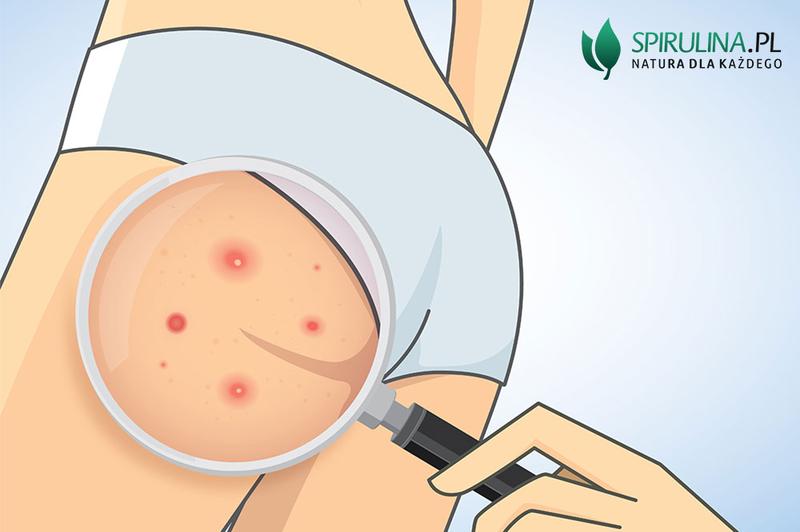 Higiena a zdrowa skóra