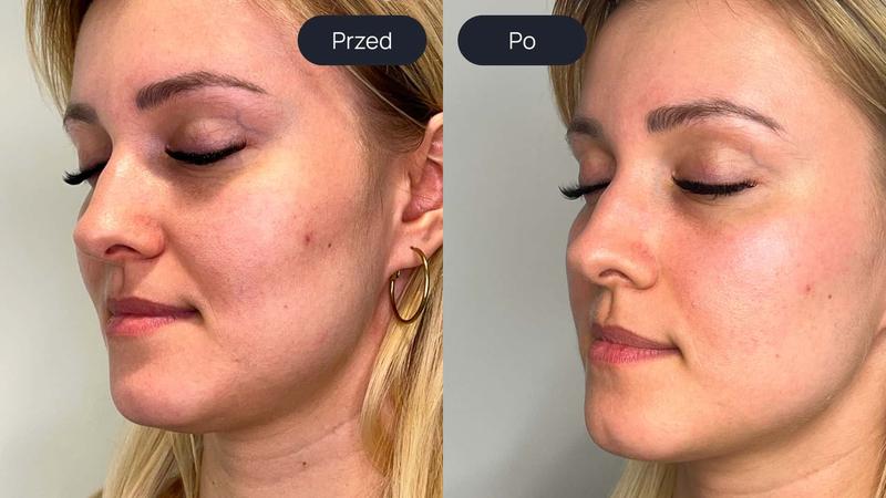 Innowacyjne technologie w dermatologii