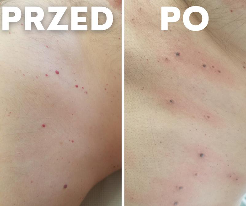 Kulinarne przepisy z pieprzykami