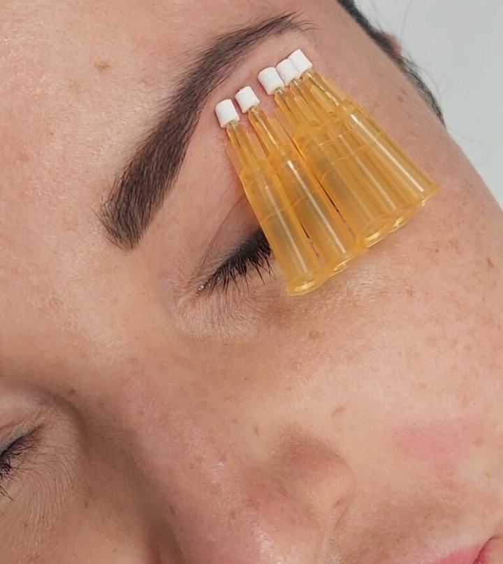 Opinie pacjentów odmładzanie