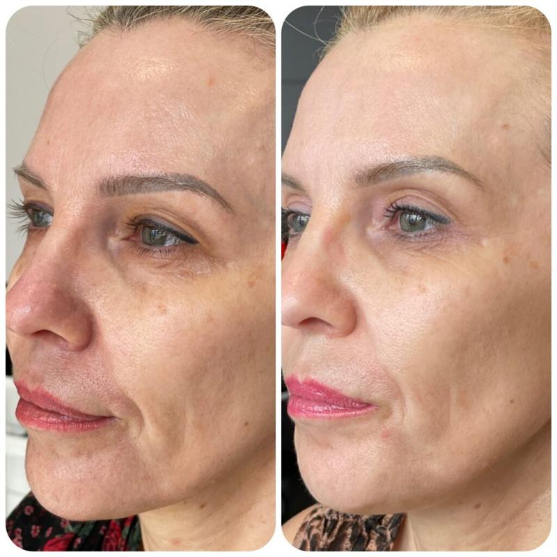 Rewolucja w dermatologii