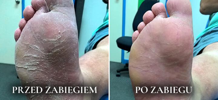 Specjalista od stóp