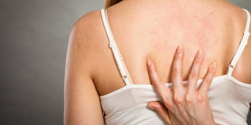 Dieta a zdrowie skóry