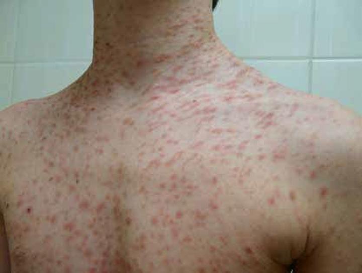 Naturalne metody leczenia