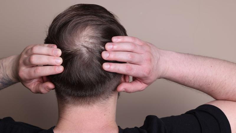 Naturalne sposoby na wzmocnienie włosów