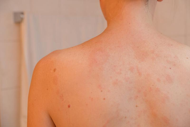 Preparaty farmakologiczne