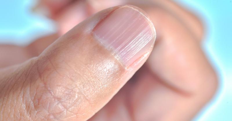 Naturalne metody wzmacniania paznokci