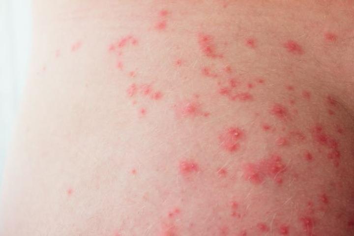 Pielęgnacja skóry nóg