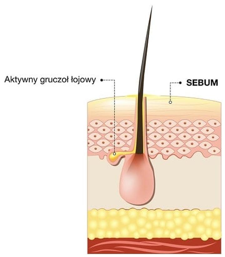 Problemy skórne związane z sebum