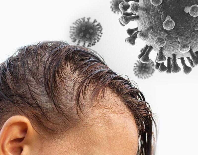 Skuteczne sposoby na wypadanie włosów