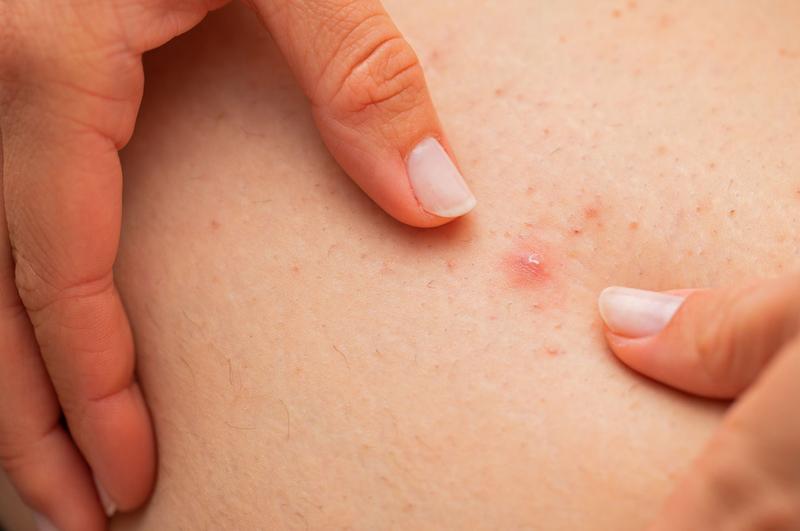 Dieta na zdrowe włosy