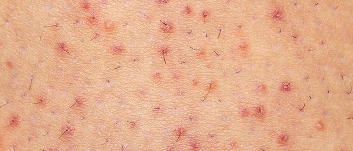 Naturalna pielęgnacja włosów