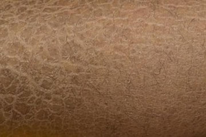 Rzadka choroba skóry rogowacenie ciemne