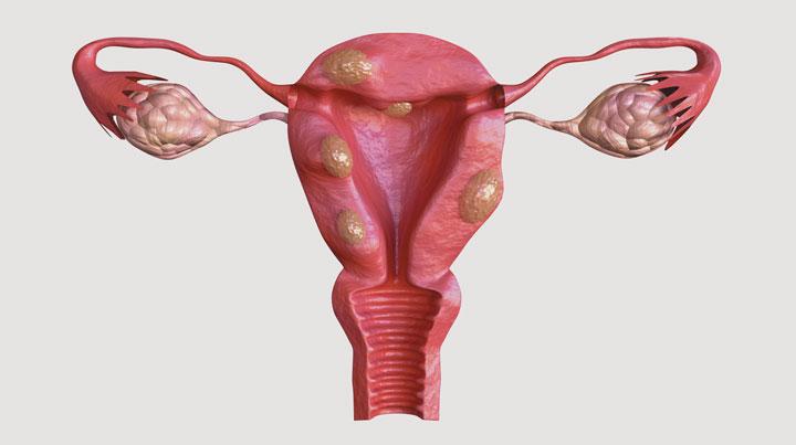 Naukowcy ujawniają: nadużywanie kosmetyków może zwiększać ryzyko endometriozy