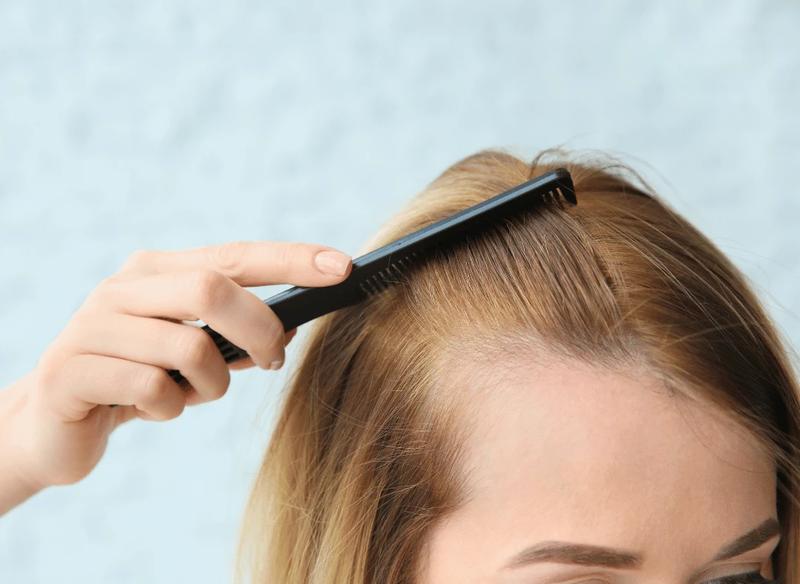 Maskowanie zakoli u kobiet