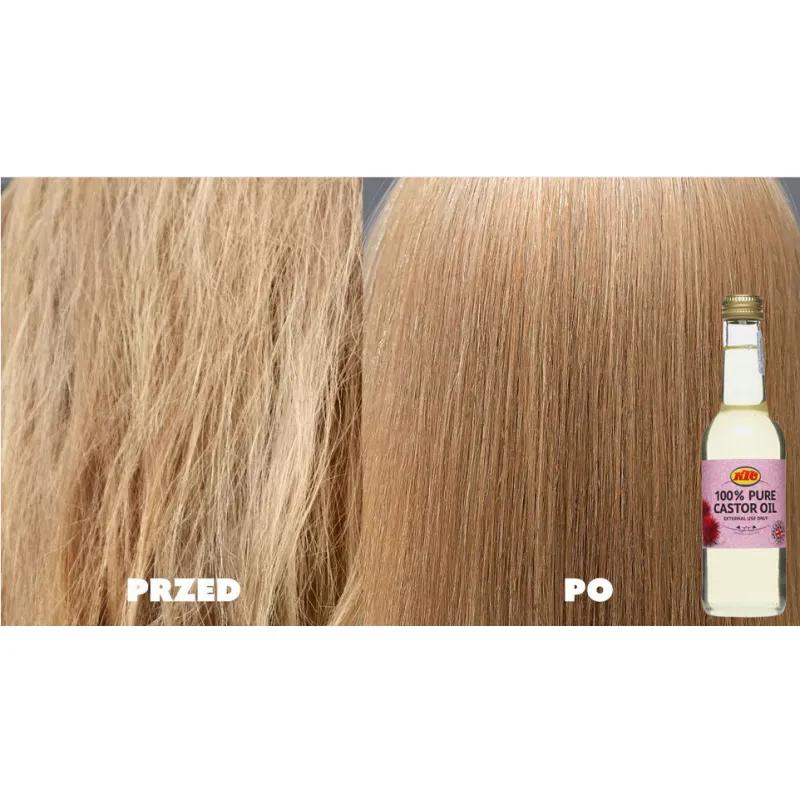 Opinie użytkowników i efekty kuracji