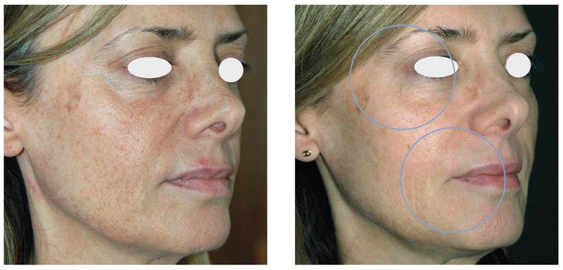 Codzienne rytuały spokoju